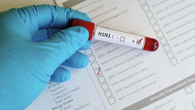 Motorista da Sesapi é enterrado em caixão lacrado por suspeita de H1N1